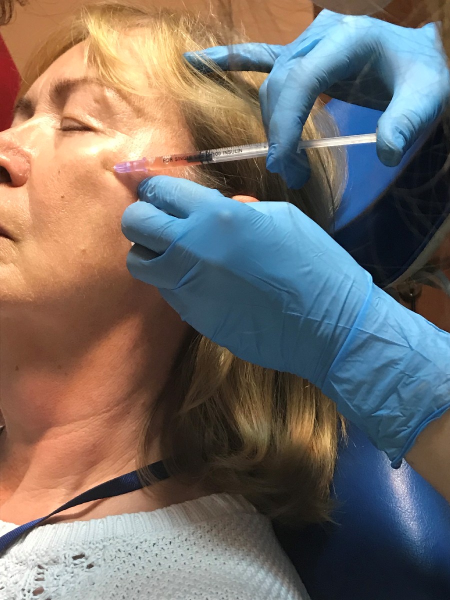 Применение плазмы с высоким содержанием фибрина (IPRF) в эстетической медицине.  17 ноября  2019. Сечко Нина Андреевна