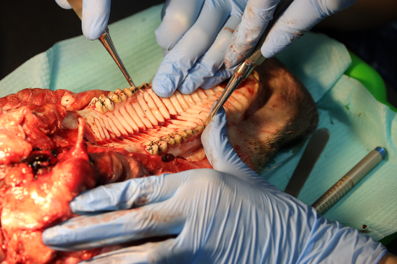 Атравматичное удаление зубов и методики наложения швов