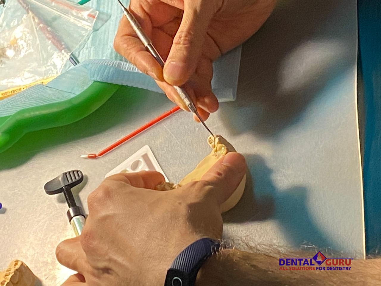 Прямые реставрации повышенной прочности. Пост-релиз 17.12.20