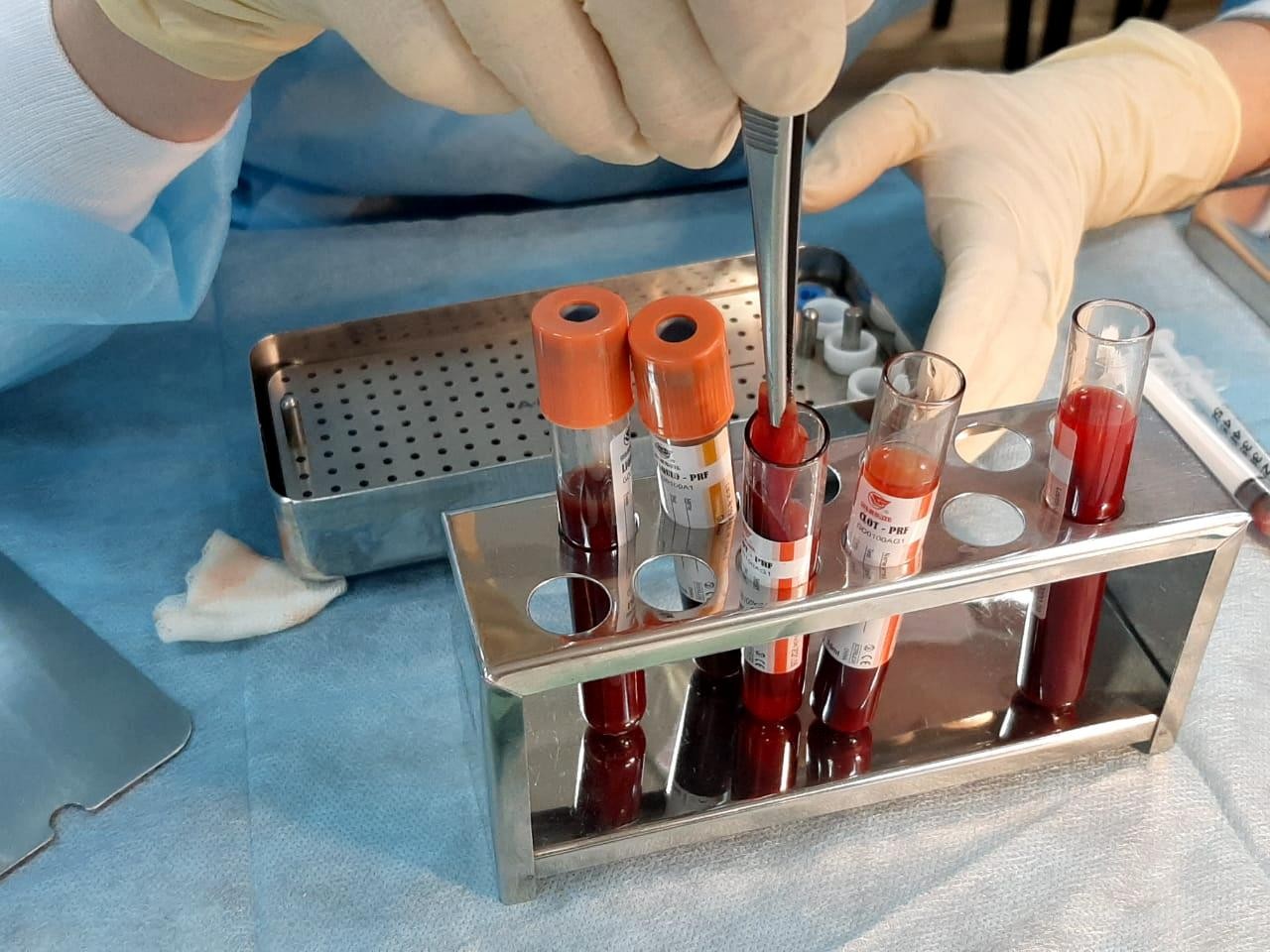 Плазмотерапия PRF в стоматологии. Курс в УЦ Дентал Гуру 3 сентября.