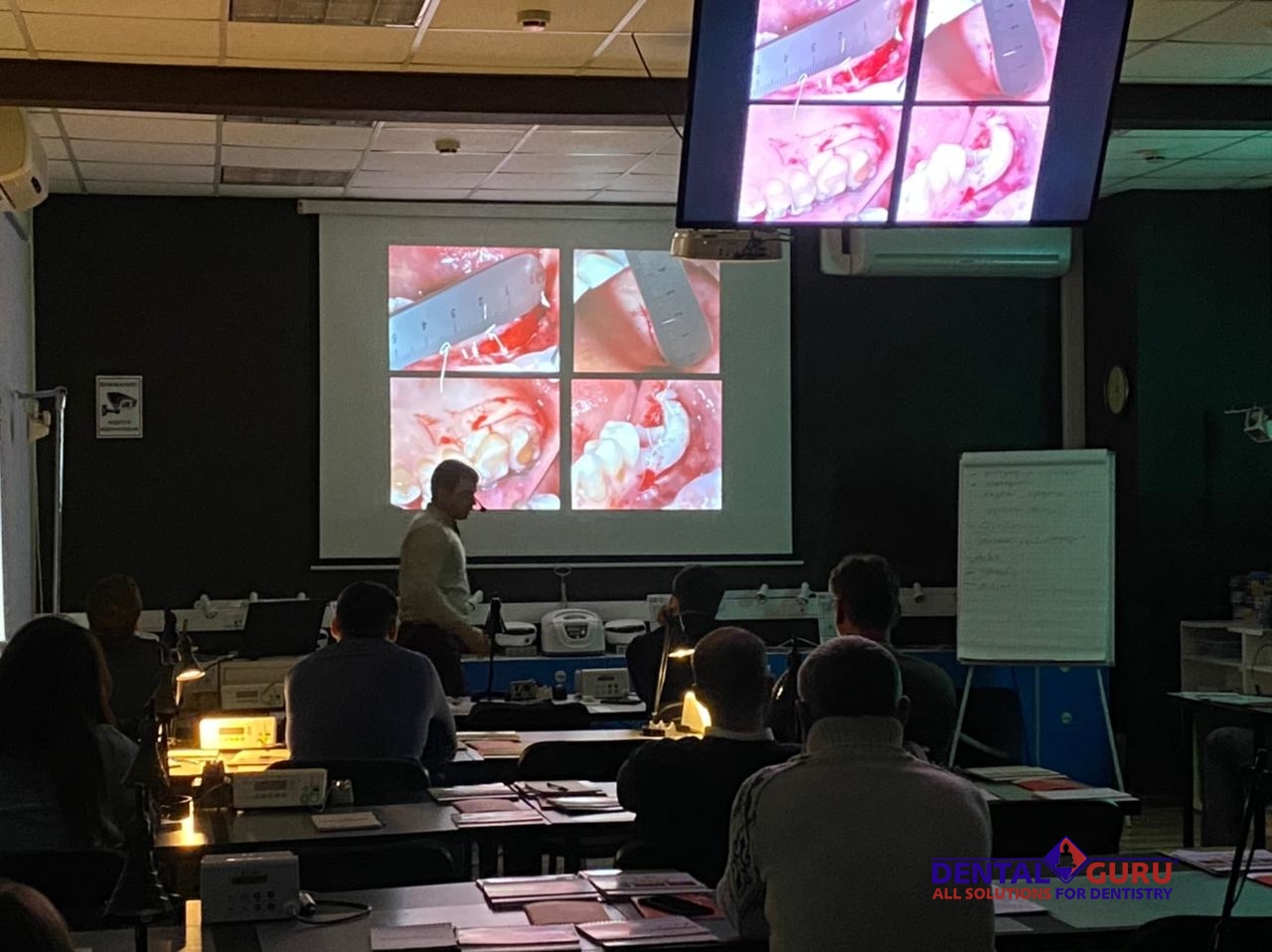 Пластика мягких тканей вокруг имплантатов. Морфологический подход. Пост-релиз 11-12 февраля