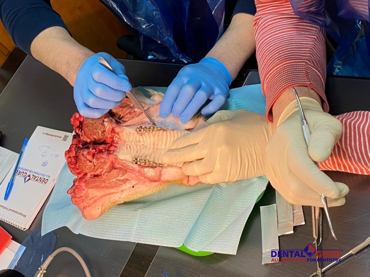 Пластика мягких тканей вокруг имплантатов. Морфологический подход. Пост-релиз 11-12 февраля