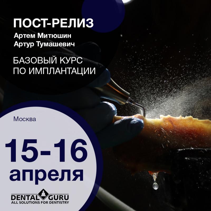 Базовый курс по имплантации. Пост-релиз 15-16 апреля