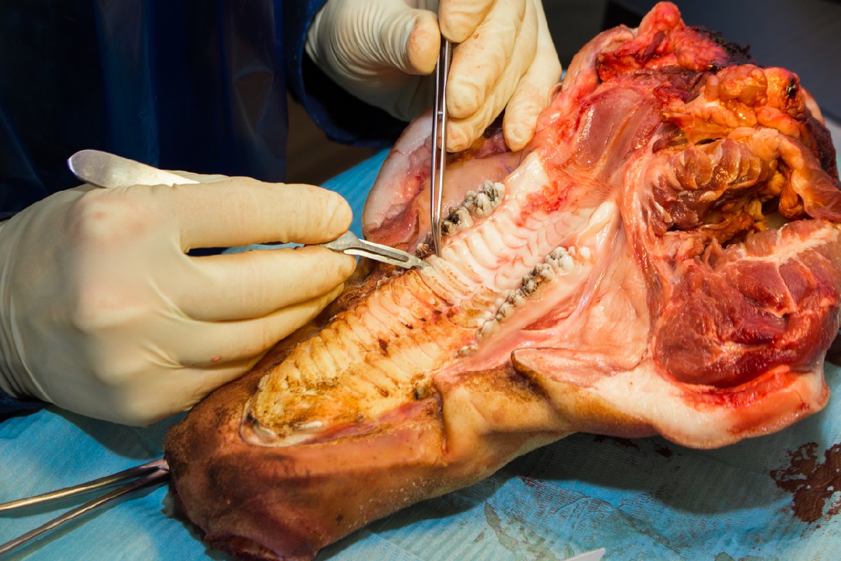 20-21 февраля 2020. Панцулая В.Г. Пластика мягких тканей вокруг имплантатов. Морфологический подход