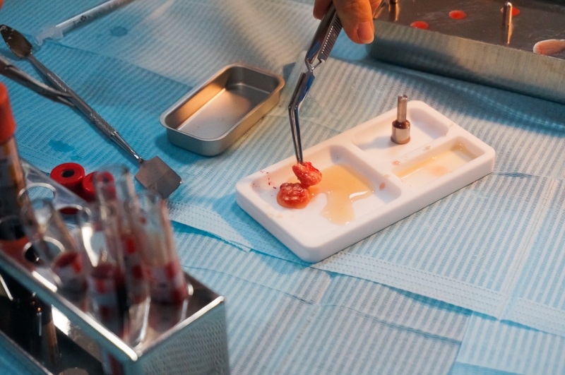 Применение факторов роста (IPRF, APRF) в стоматологии