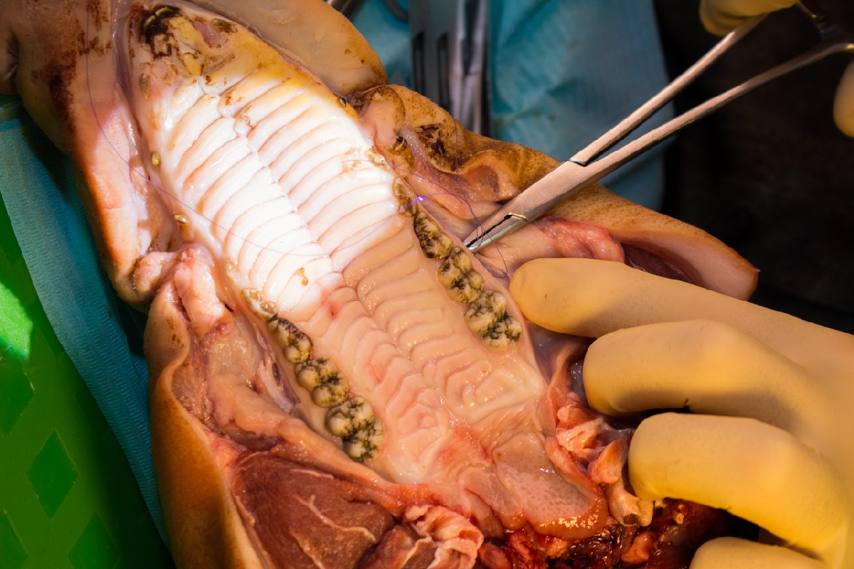 20-21 февраля 2020. Панцулая В.Г. Пластика мягких тканей вокруг имплантатов. Морфологический подход