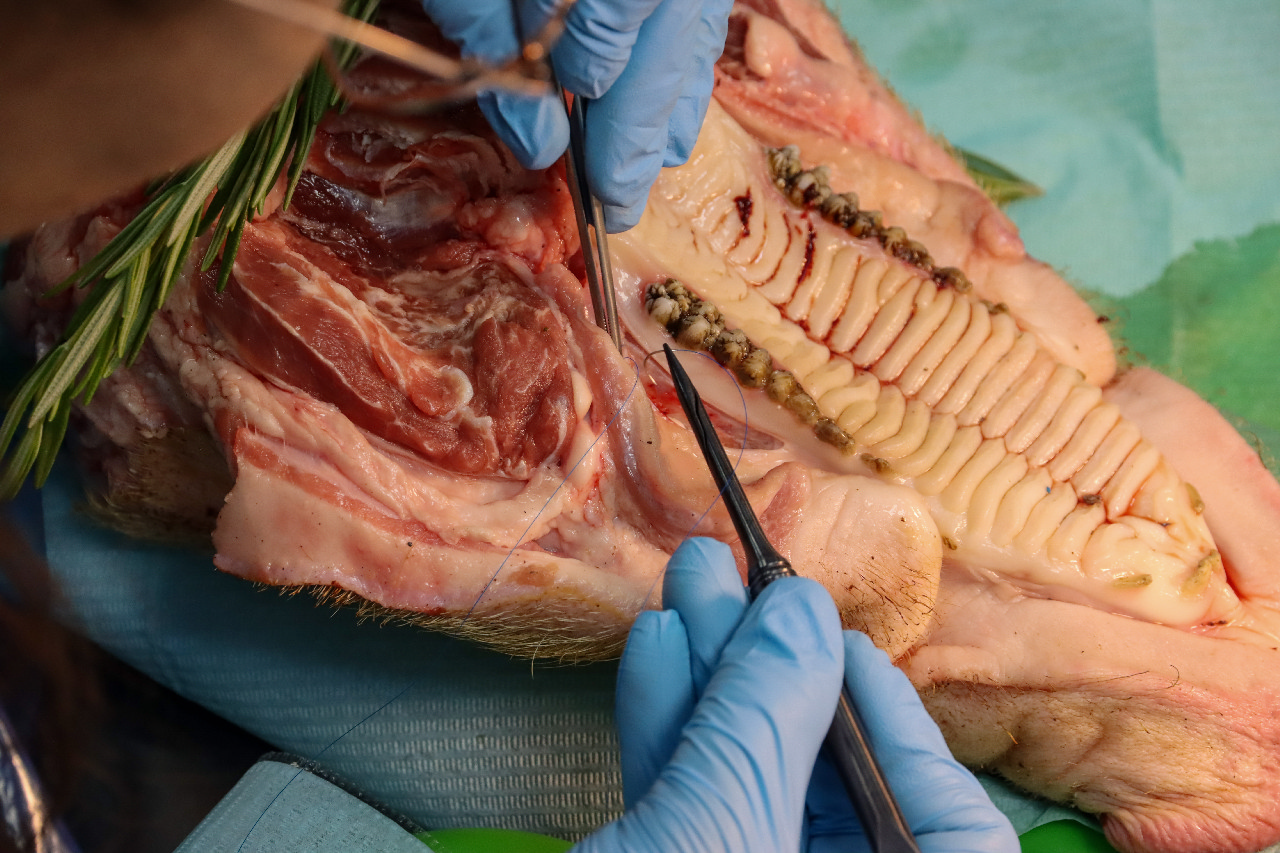 Пластика мягких тканей вокруг имплантатов. Морфологический подход. Пост-релиз 15-16 сентября