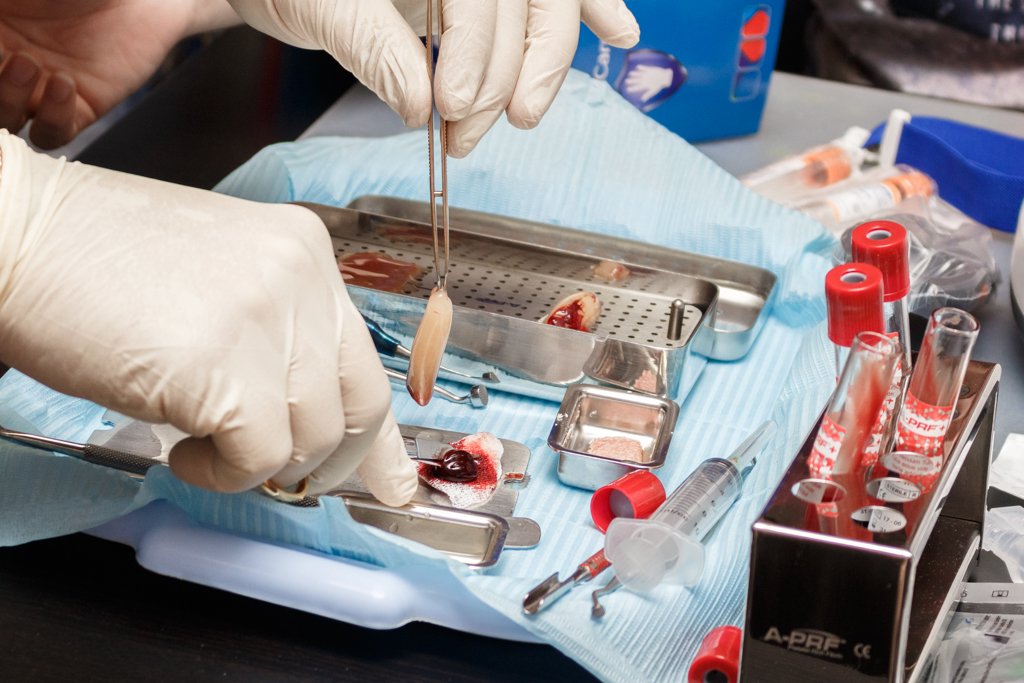 Применение факторов роста (IPRF, APRF) в стоматологии