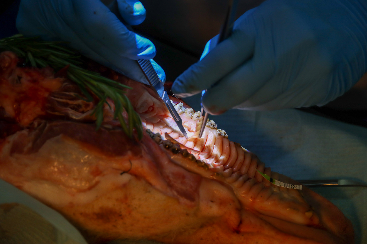 Пластика мягких тканей вокруг имплантатов. Морфологический подход