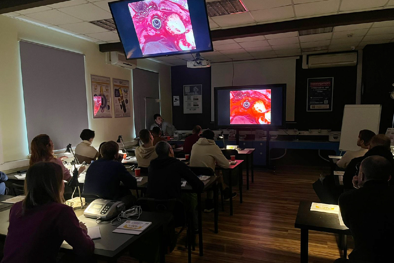 Одномоментная имплантация и немедленная нагрузка