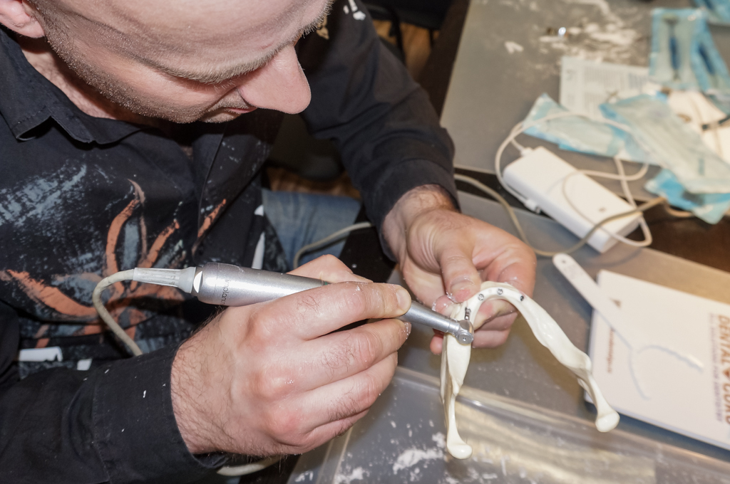 Стоматологическая реабилитация с помощью ангулированных имплантов. Физиологическое и анатомическое обоснование