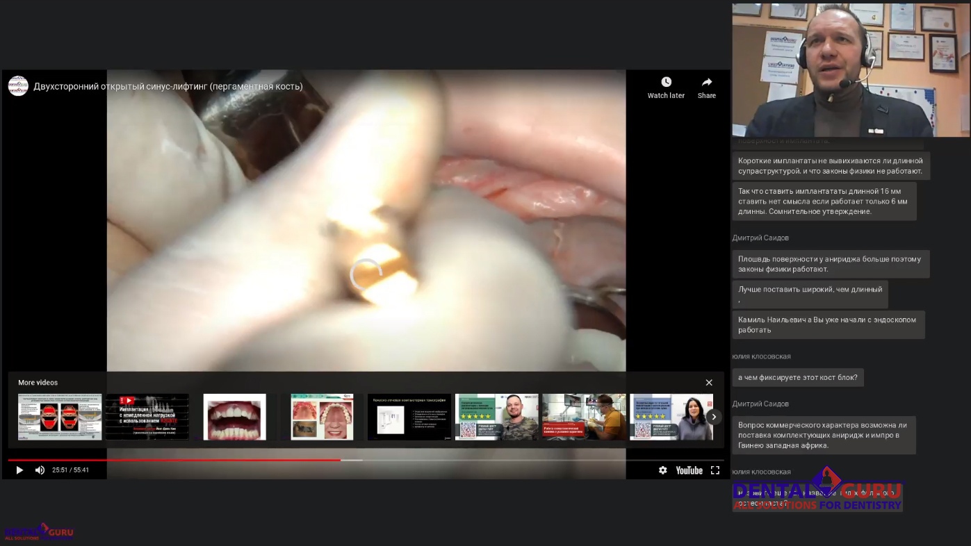 Пост-релиз: Взаимодействие имплантолога и лор-врача при проведении имплантации и костной пластики в компрометированной пазухе