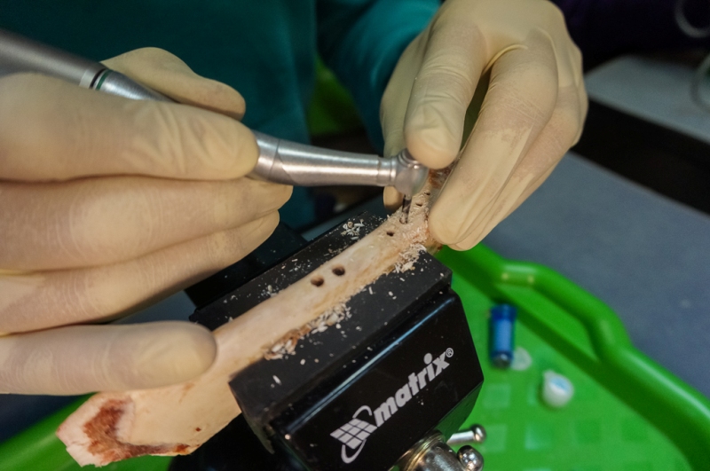 Базовый курс по имплантации в Москве