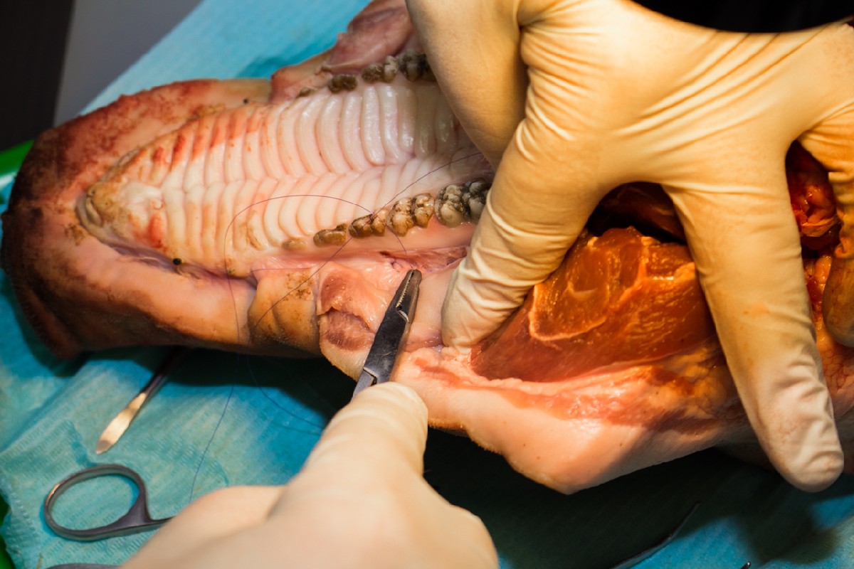 20-21 февраля 2020. Панцулая В.Г. Пластика мягких тканей вокруг имплантатов. Морфологический подход