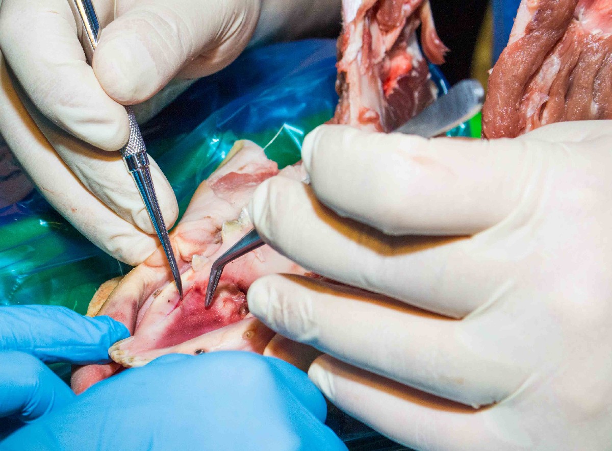 13-14 ноября. Хирургический курс по пародонтологии. Ерохин А.И.