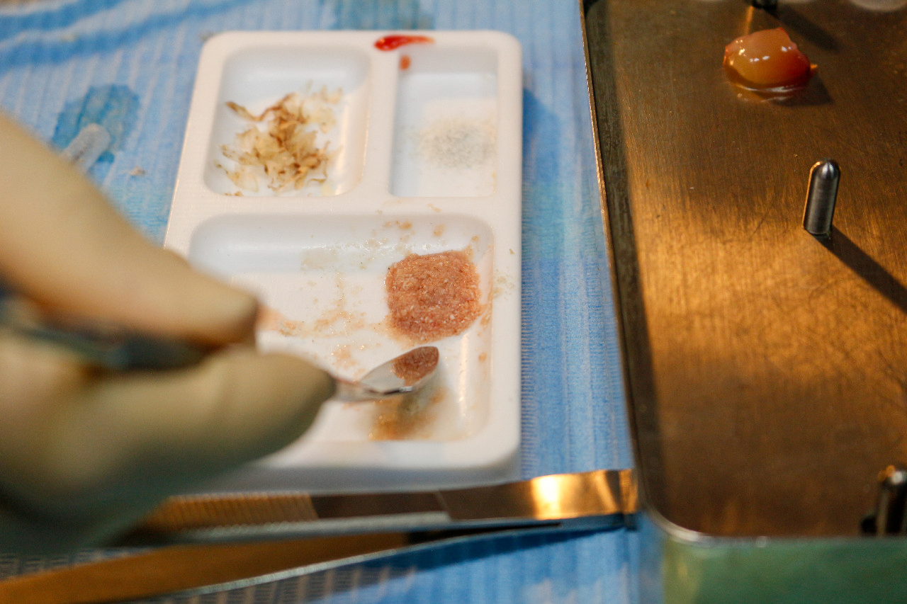 Плазмотерапия PRF в стоматологии 29.09.23