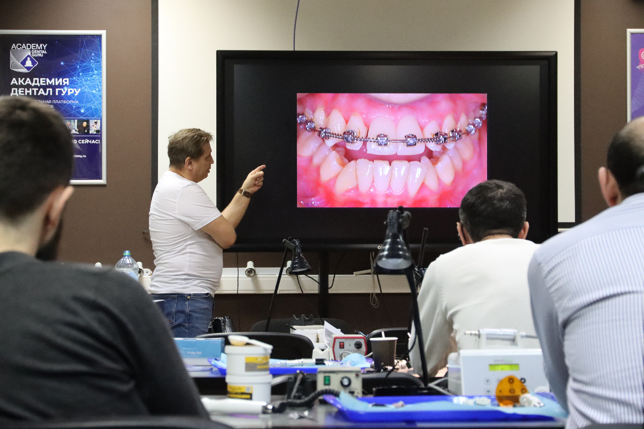 Прямые композитные виниры. Полный алгоритм и немного больше