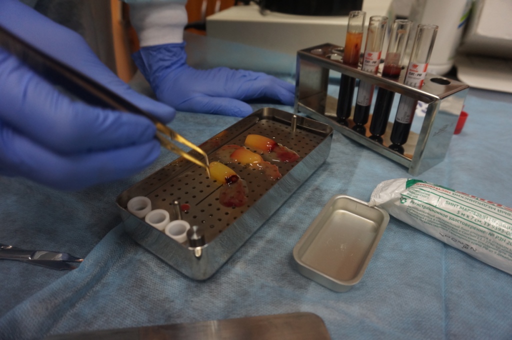 Лекция по аутоплазмотерапии: применение факторов роста А-PRF и I-PRF в стоматологии. Контурная пластика жидким PRF нижней трети части лица