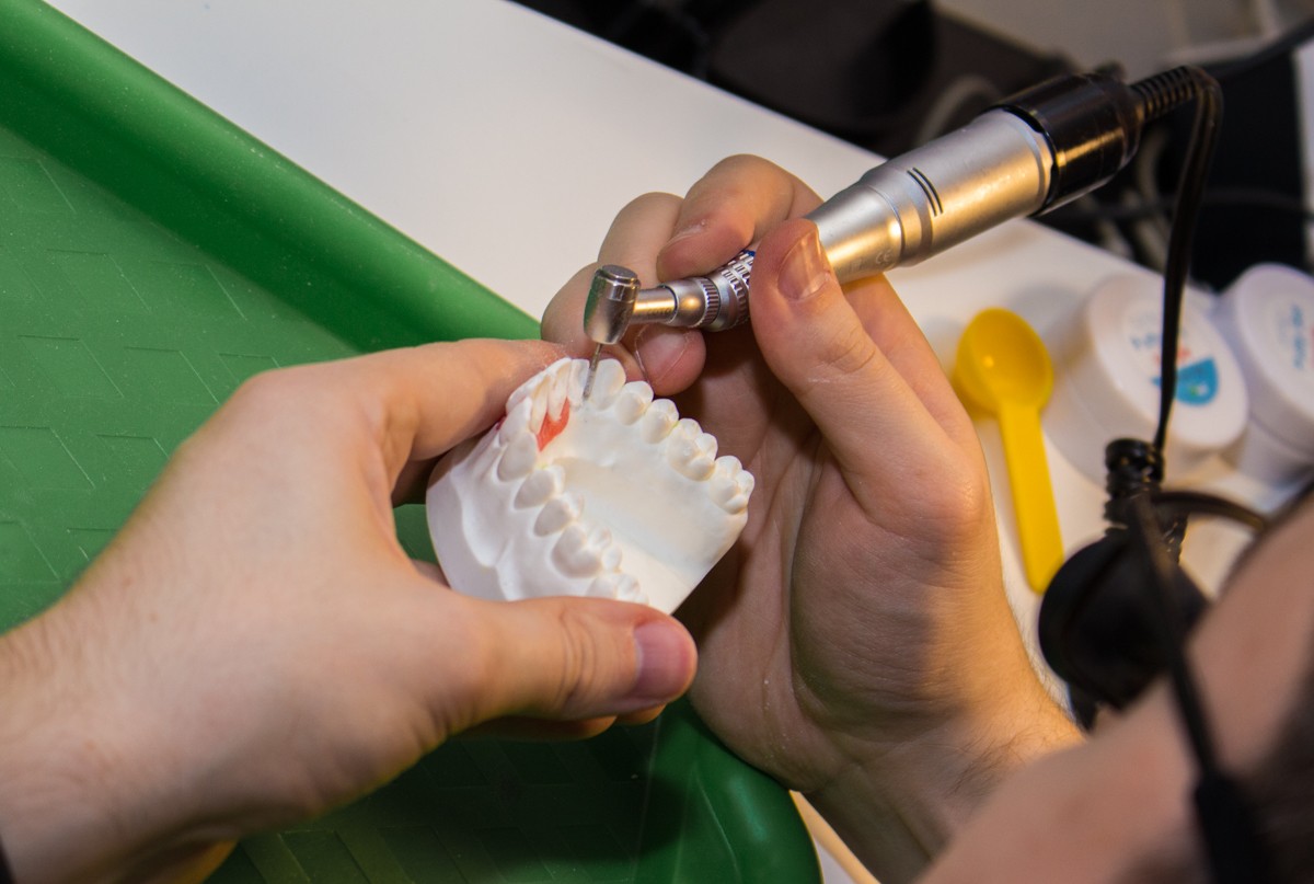 Препарирование зубов под цельнокерамические реставрации во фронтальном отделе, 26 февраля 2020г.