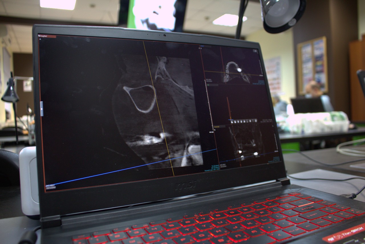 Пост-релиз. Кадавер-курс 1 марта