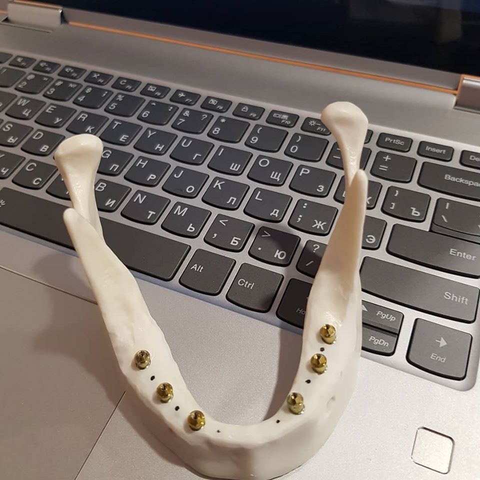 Пермь, 16 ноября: Экспертный курс по тотальной имплантации и протезированию при полном отсутствии зубов. Данилов А.А.