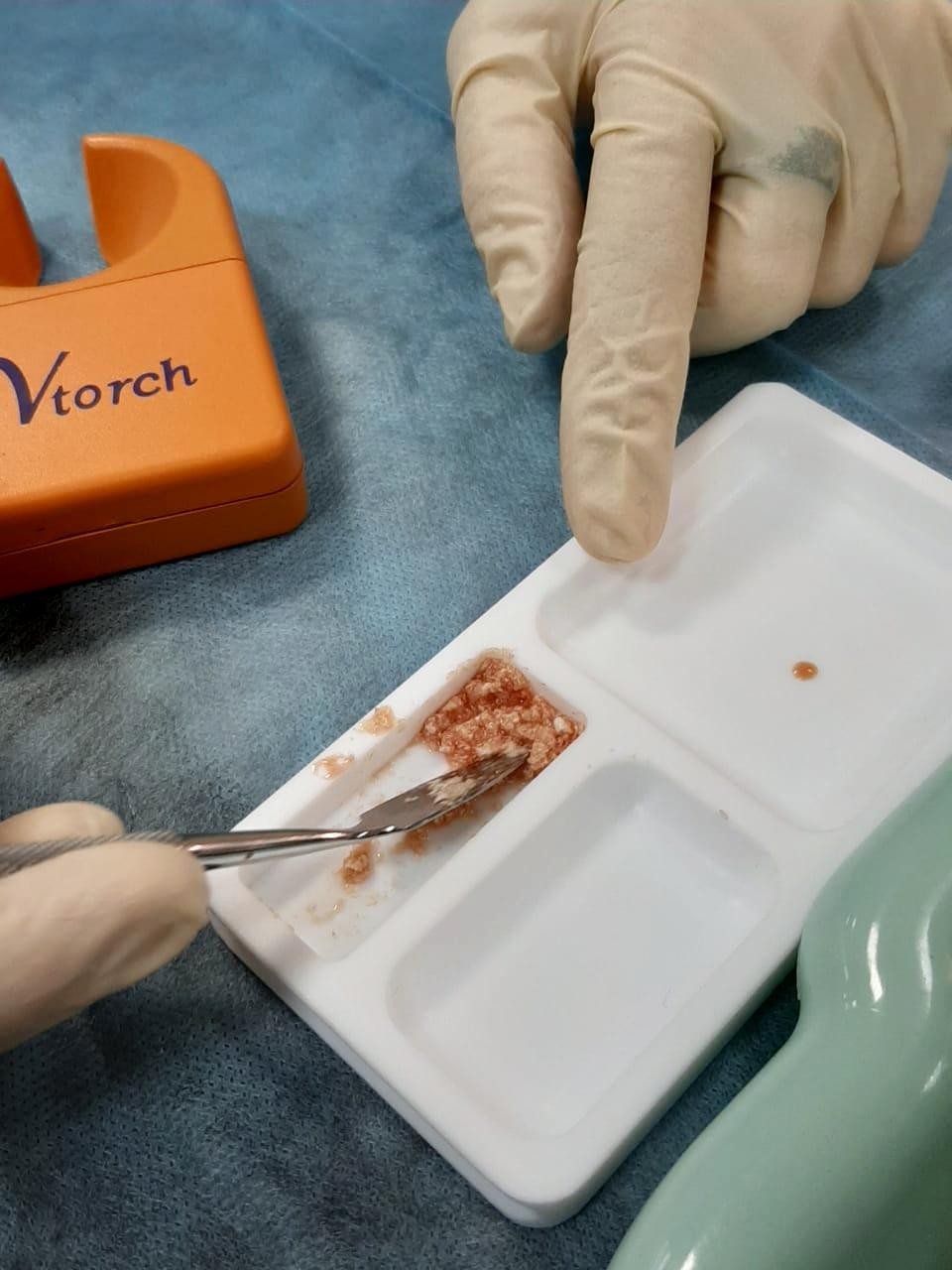 Плазмотерапия PRF в стоматологии. Курс в УЦ Дентал Гуру 3 сентября.