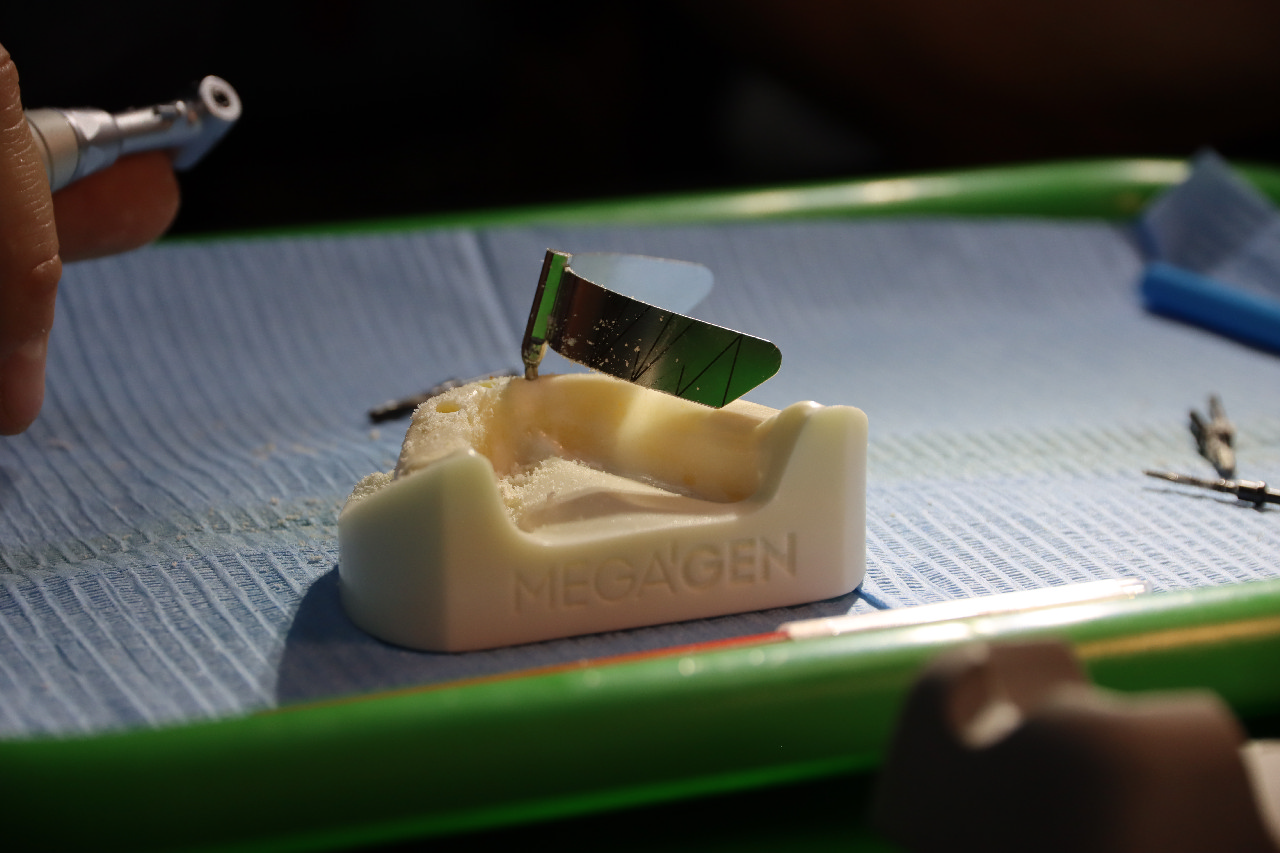 Экспертный курс по тотальной имплантации и протезированию при полном отсутствии зубов