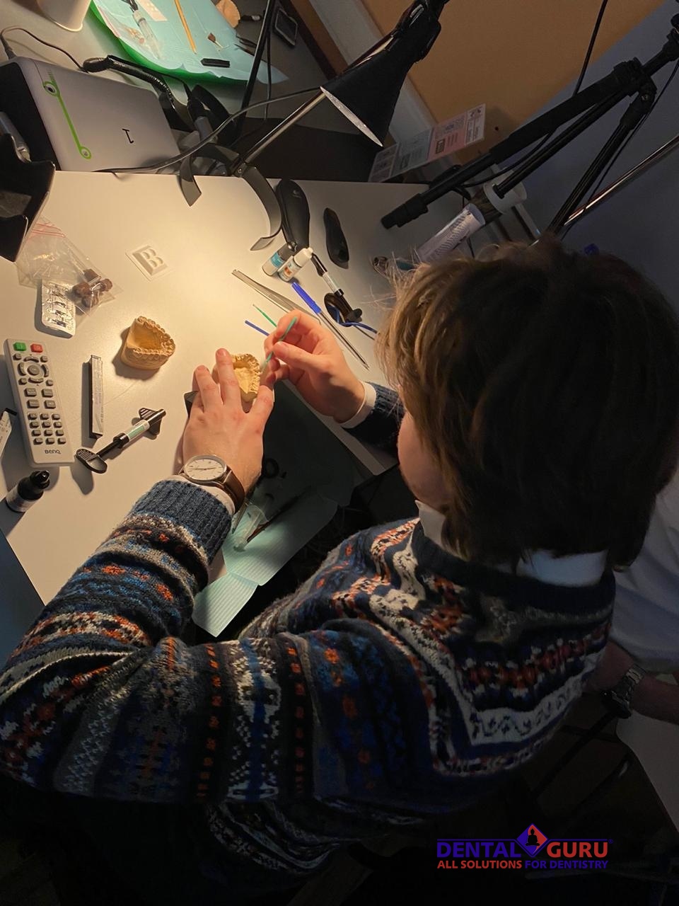 Прямые реставрации повышенной прочности. Пост-релиз 17.12.20