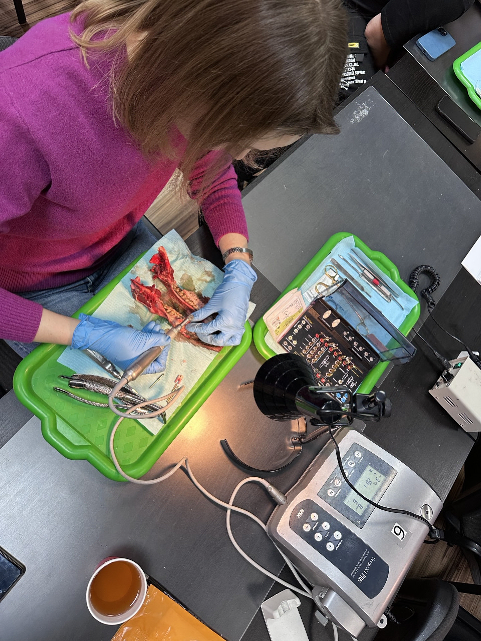 Одномоментная имплантация и немедленная нагрузка