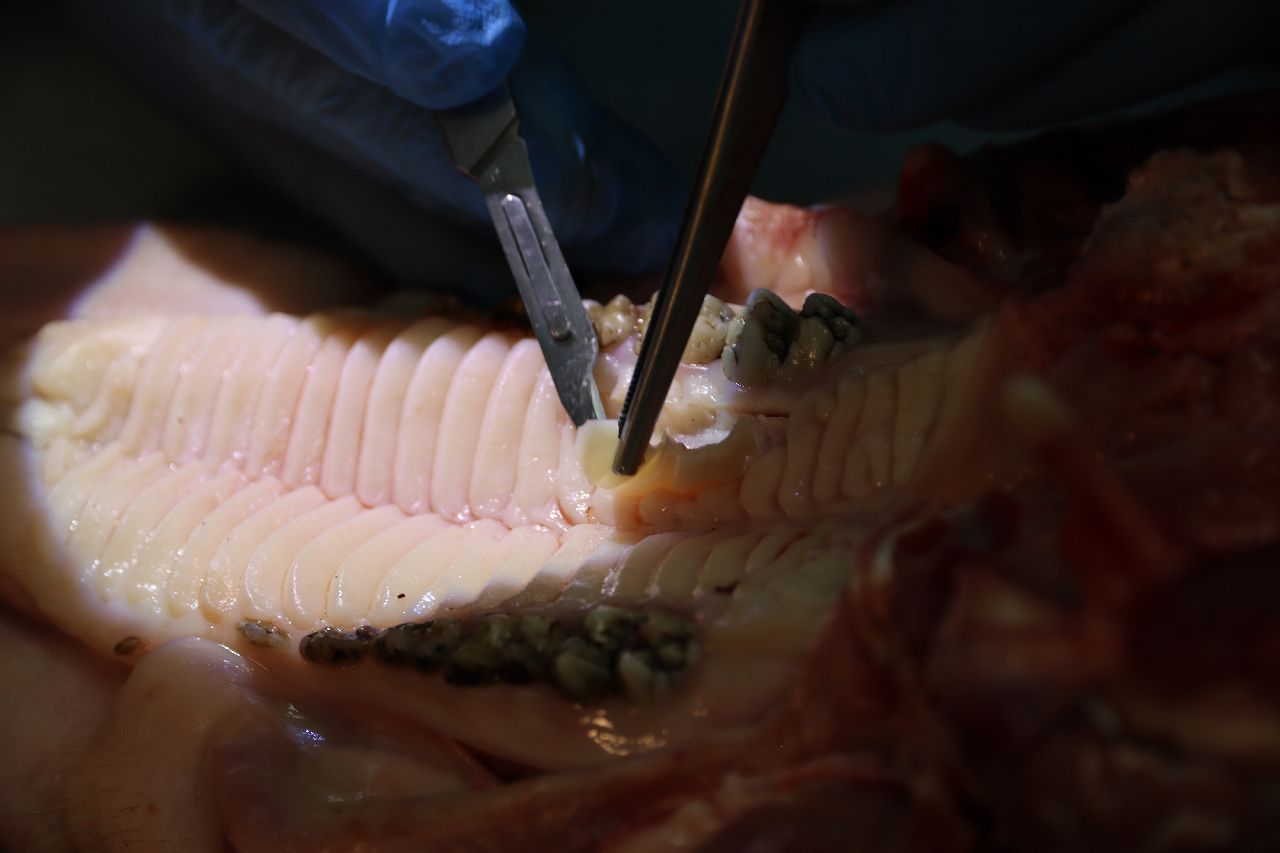 Пластика мягких тканей вокруг имплантатов. Морфологический подход