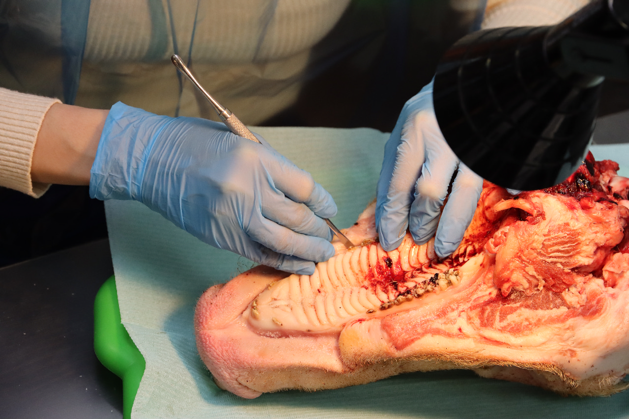 Атравматичное удаление зубов и методики наложения швов