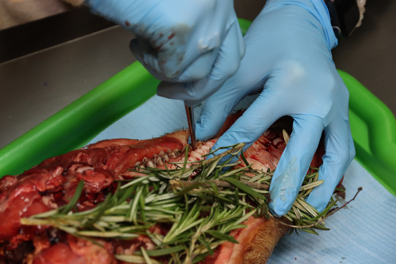 Атравматичное удаление зубов и методики наложения швов