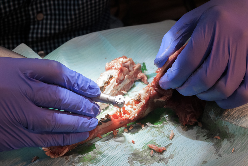 Одномоментная имплантация и немедленная нагрузка