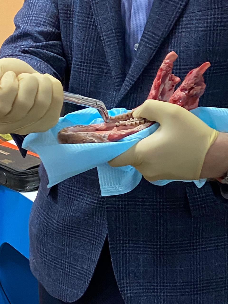 Атравматичное удаление зубов и методики наложения швов. Пост-релиз 11.12.20