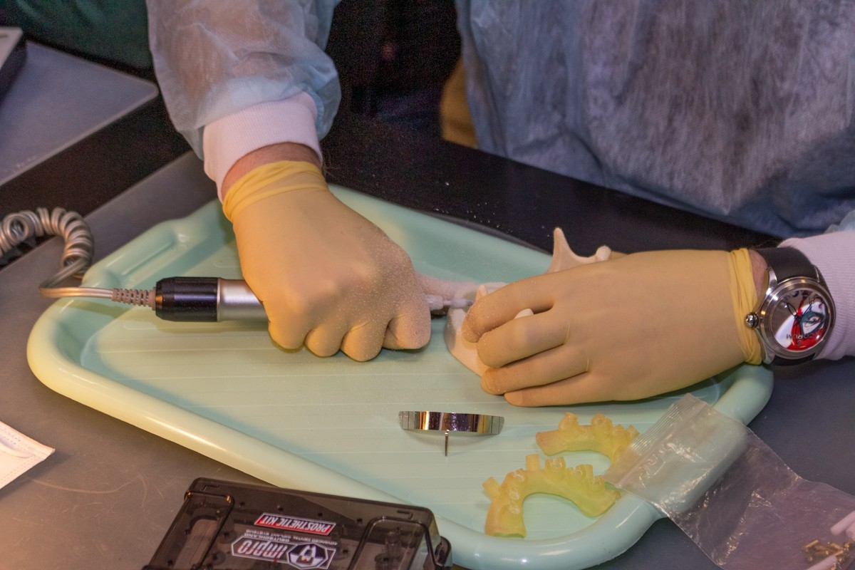 Стоматологическая реабилитация с помощью ангулированных имплантатов. 5 февраля 2020, Данилов Александр Алексеевич