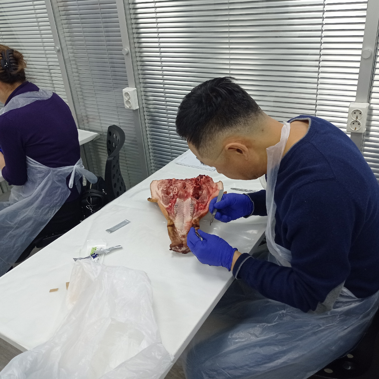 Пластика мягких тканей вокруг имплантатов. PRF в стоматологии. Курс в Казахстане