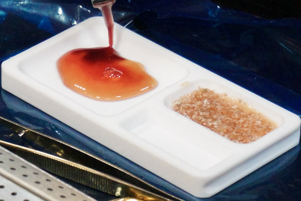 Применение факторов роста (IPRF, APRF) в хирургии и костной пластике