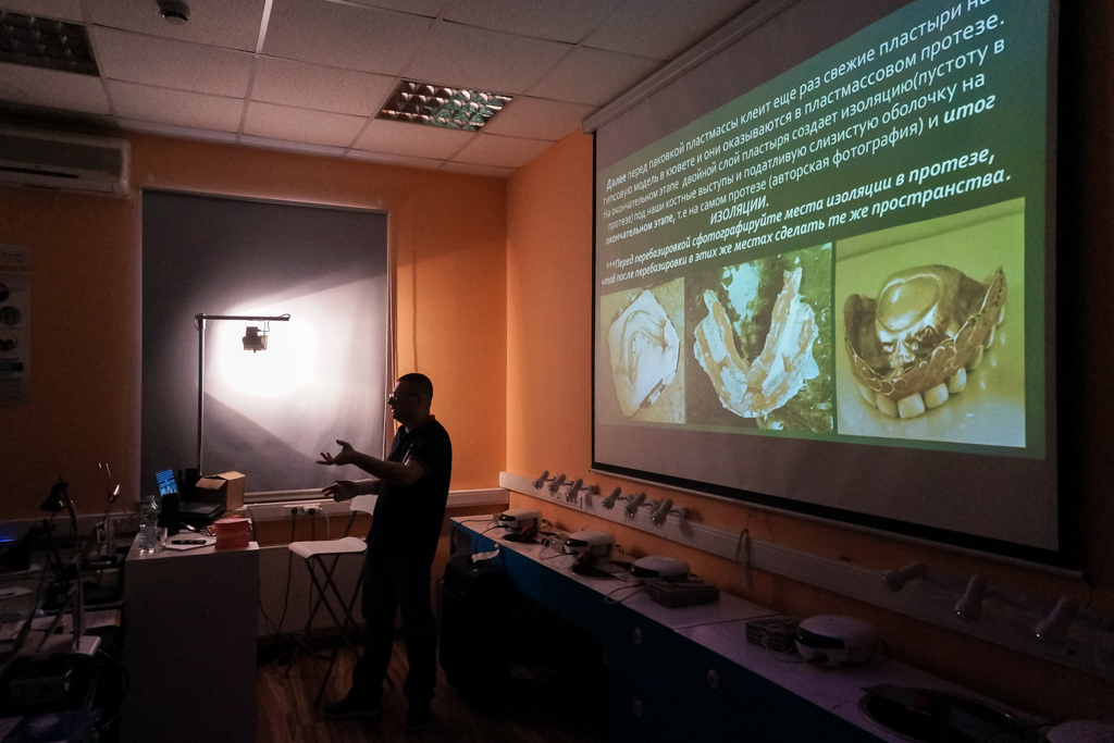 Полное съемное протезирование