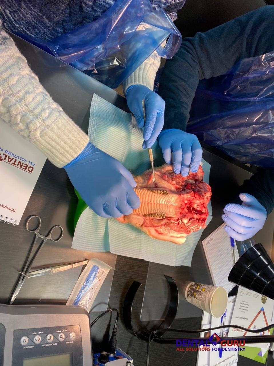 Пластика мягких тканей вокруг имплантатов. Морфологический подход. Пост-релиз 11-12 февраля