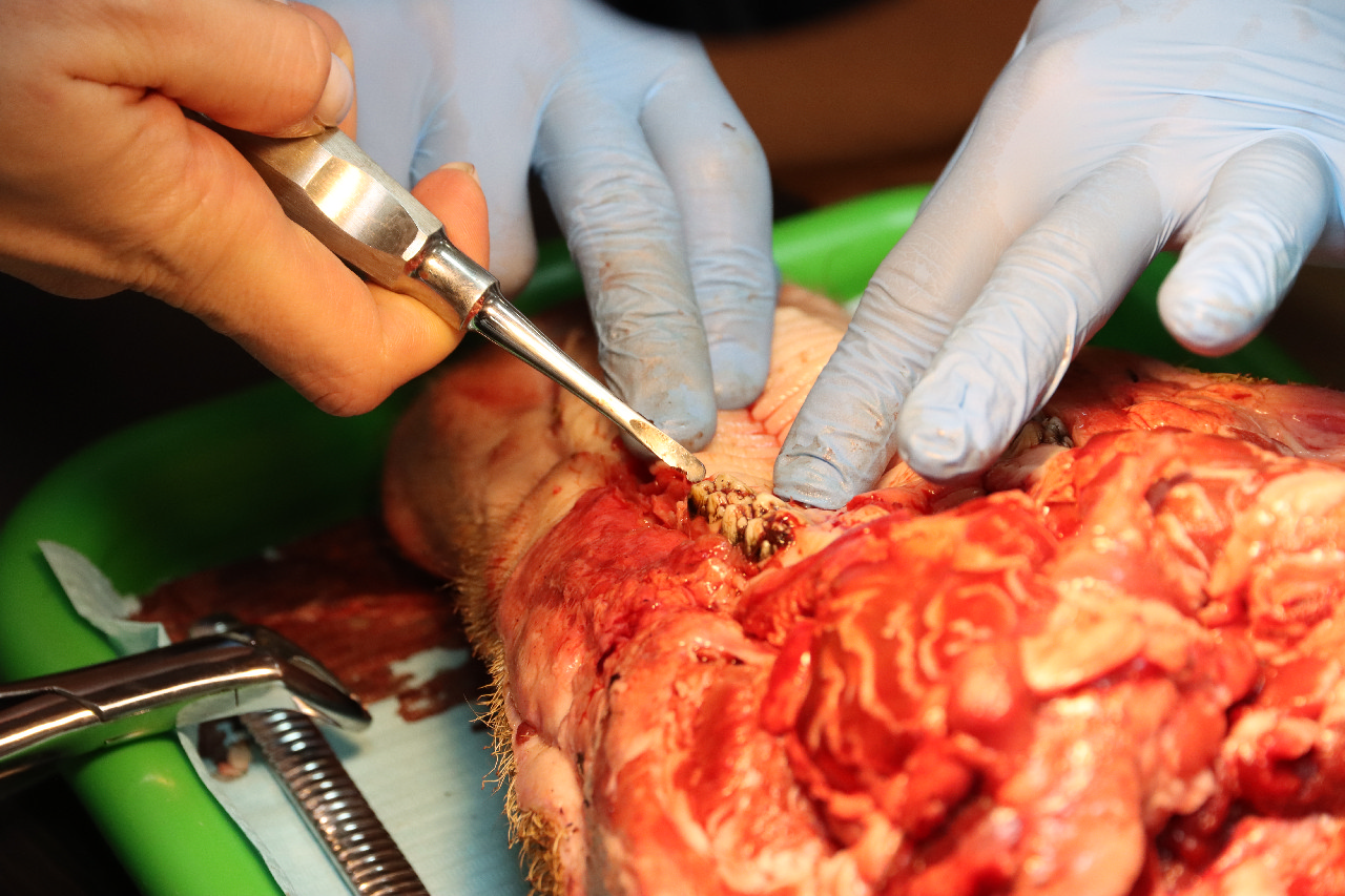 Атравматичное удаление зубов и методики наложения швов