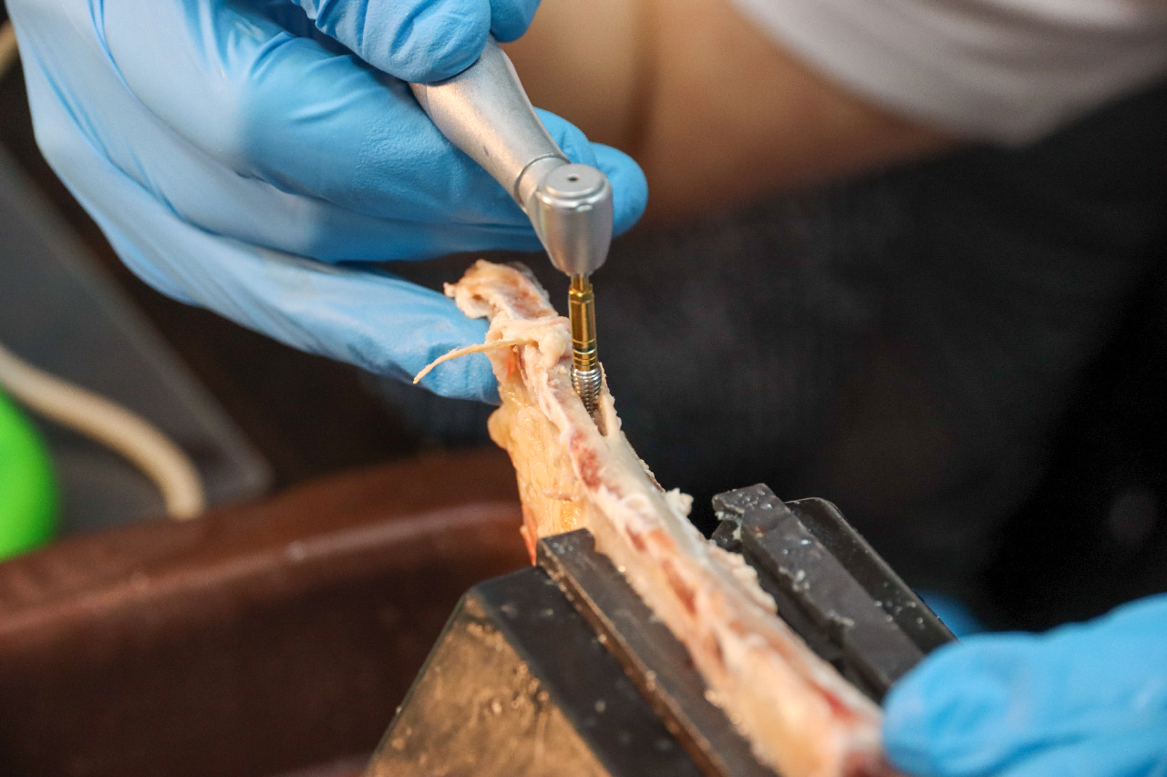 Продвинутый курс по имплантации: костная пластика и синус-лифтинг 13-14 сентября