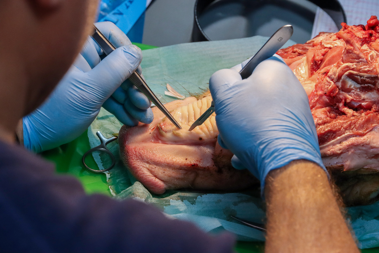 Пластика мягких тканей вокруг имплантатов. Морфологический подход. Пост-релиз 15-16 сентября