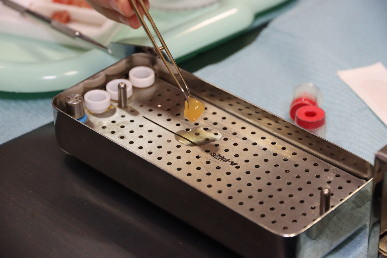 Плазмотерапия PRF в стоматологии