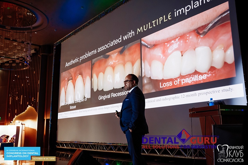 19-20 октября 2019. III Международный имплантологический конгресс в Ялте