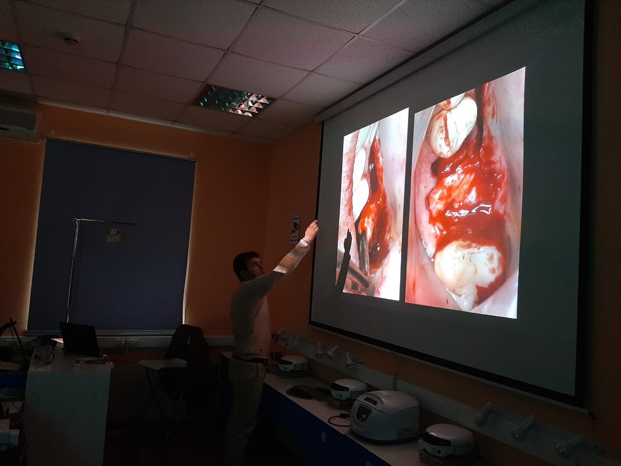 16-17 сентября 2020. Панцулая В.Г. Пластика мягких тканей вокруг имплантатов. Морфологический подход