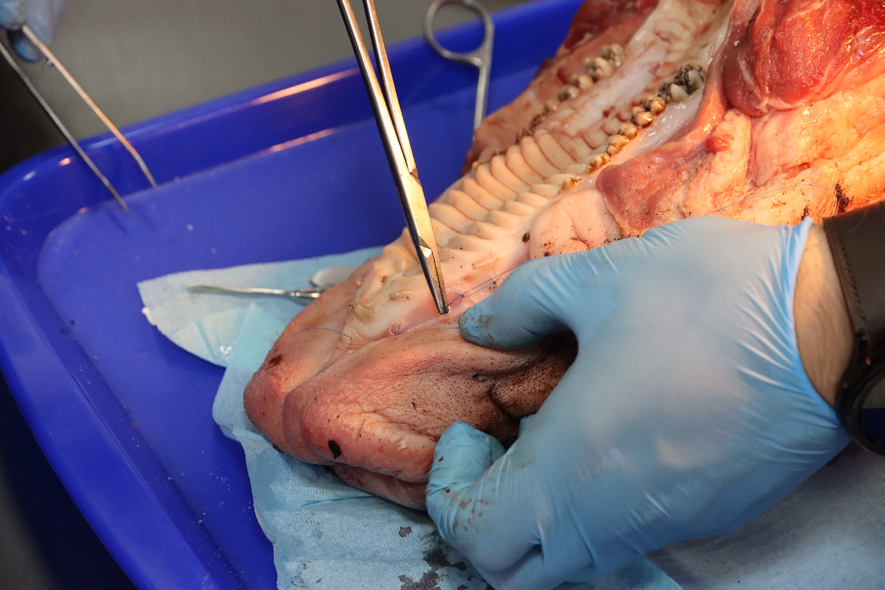 Пластика мягких тканей вокруг имплантатов. Морфологический подход