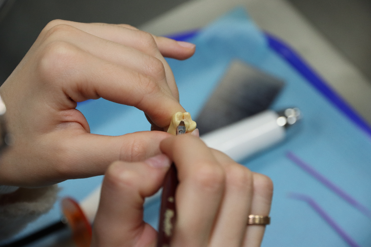 Прямые методы реставраций жевательной группы зубов