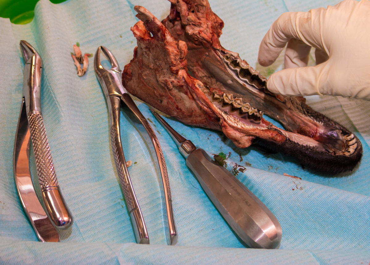 Одномоментная имплантация и немедленная нагрузка. 3 февраля 2020