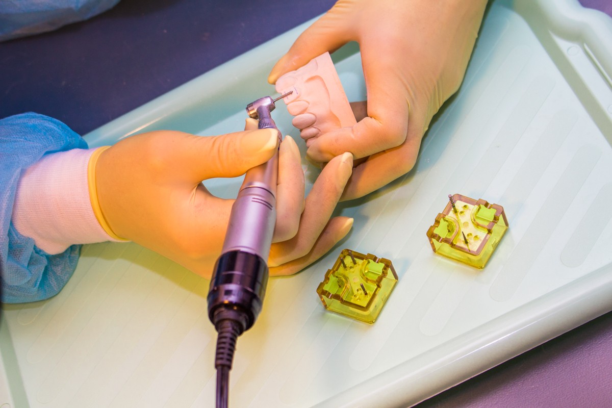 Препарирование зубов под цельнокерамические реставрации во фронтальном отделе, 26 февраля 2020г.