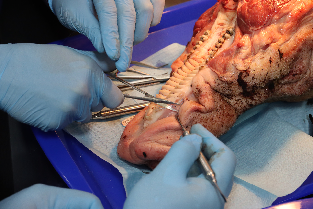 Пластика мягких тканей вокруг имплантатов. Морфологический подход